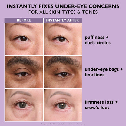 Perfecting Eye Tightener